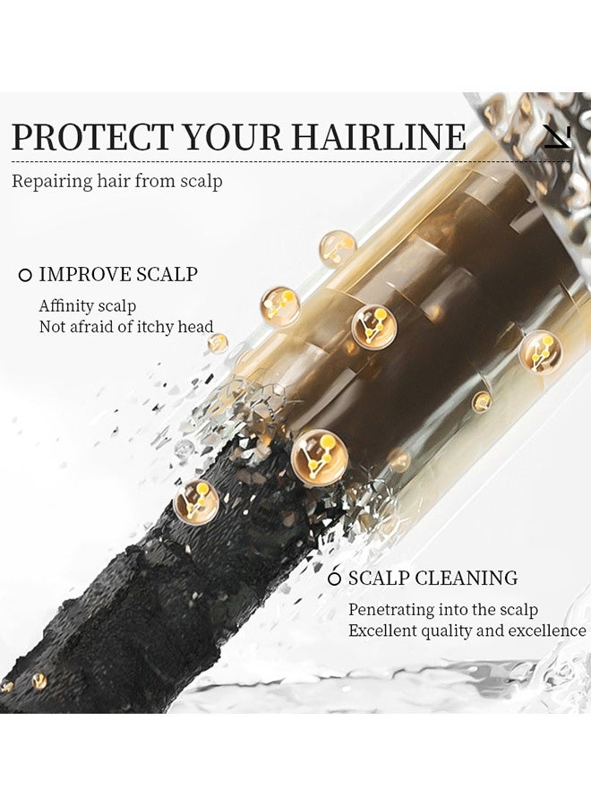 Kormesic 5% Minoxidil With Biotin Shampoo 300ml, Hair Growth Treatment Shampoo With Minoxidil 5% Strengthen Hair Promote Hairs Regrowth Reduce Hairs Loss Removes Dandruff & Relieve Itching - Image 4